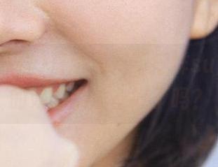 First Image