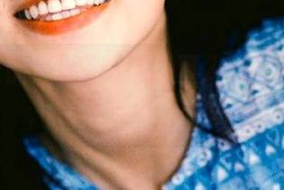 First Image